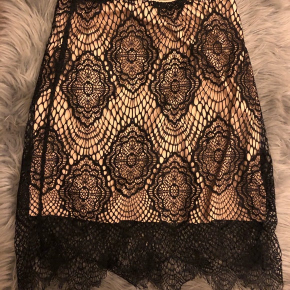 Cute lace skirt🍋 - Picture 3 of 4